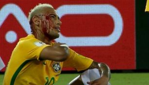 Neymar, ensangrentado tras el codazo de Duk