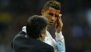 Médico asistió a Cristiano Ronaldo tras recibir golpe en el rostro