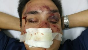 Sebastián Acosta terminó gravemente lesionado