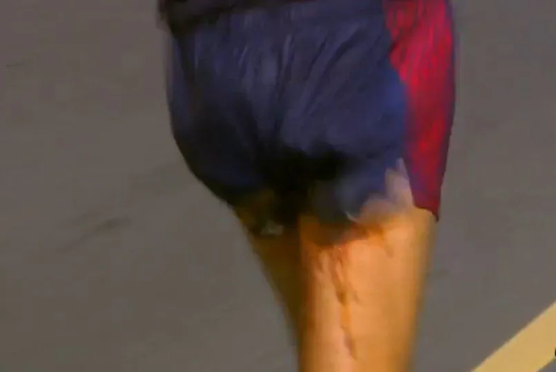 ESPECIAL Momento en que Diniz sufre accidente estomacal