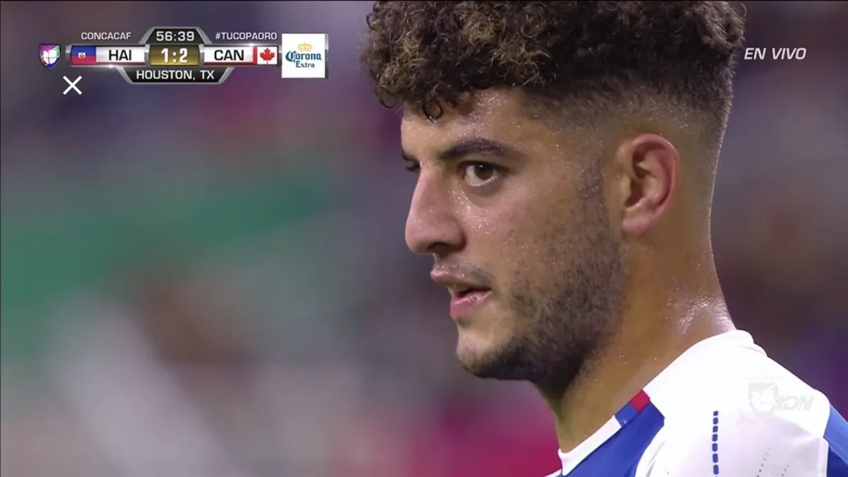 UNIVISIÓN Steeven Saba, durante el partido contra Canadá