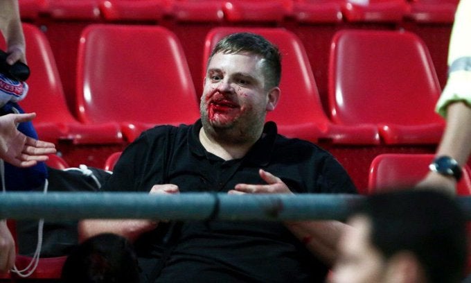 Un aficionado alemán tras ser golpeado en el estadio 