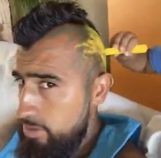 El hijo de Vidal le pinta la cabeza