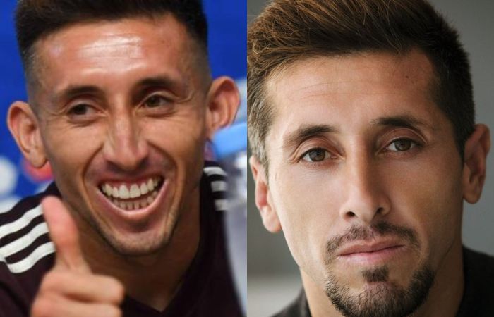 Héctor Herrera antes y después de sus cirugías estéticas