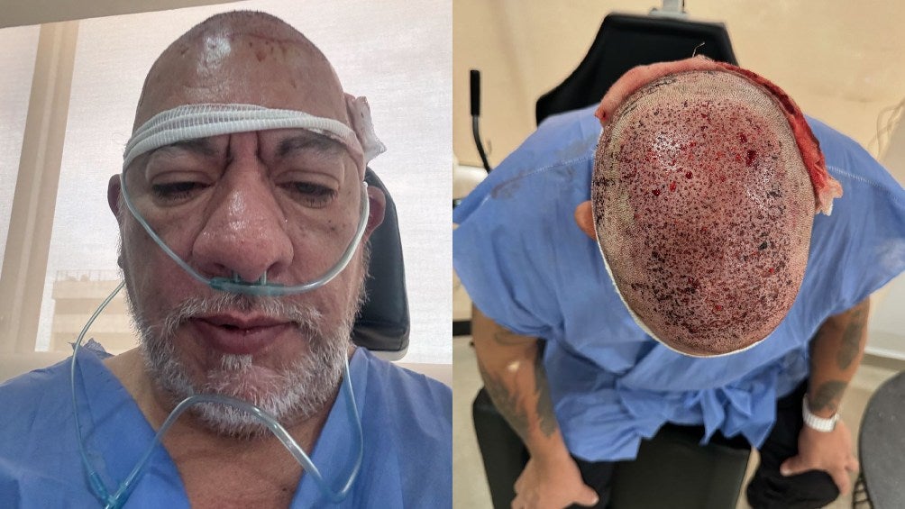 IG: @ct_caza El cazafantasmas se realizó un tratamiento para tener cabello.