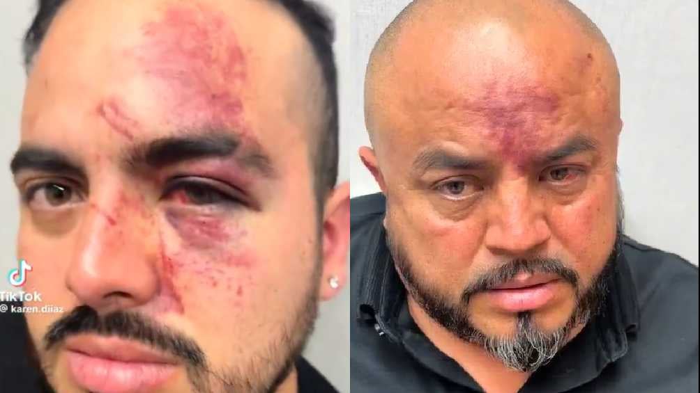 TikTok: @papamillonario Acusaron que 20 policías de Zumpango los golpearon.