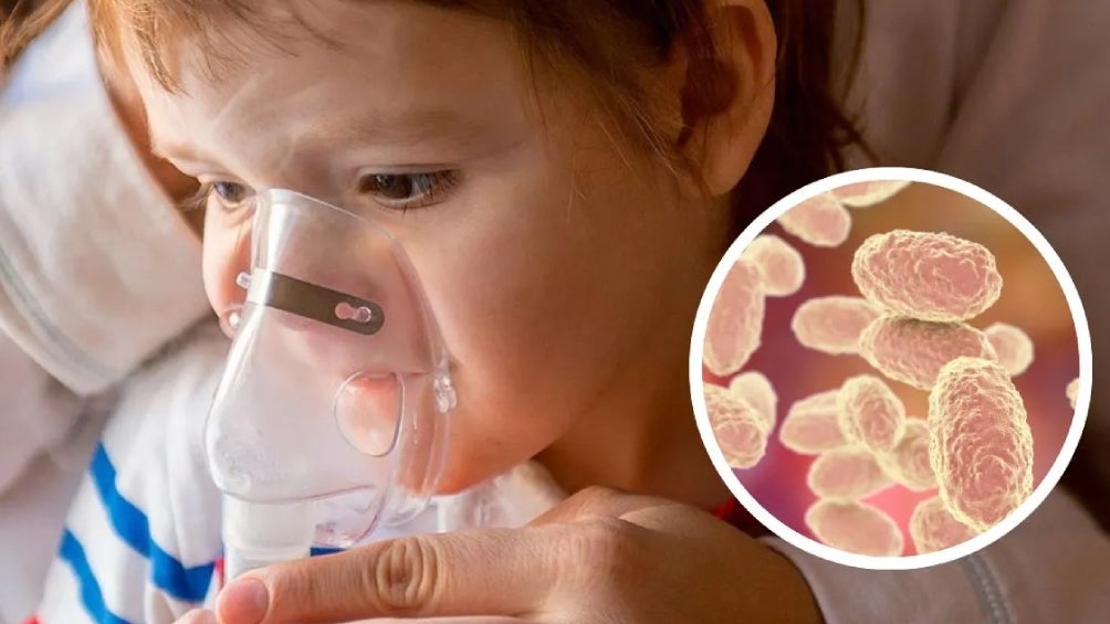 La CDMX encabeza la lista con más contagios de tos ferina en el país