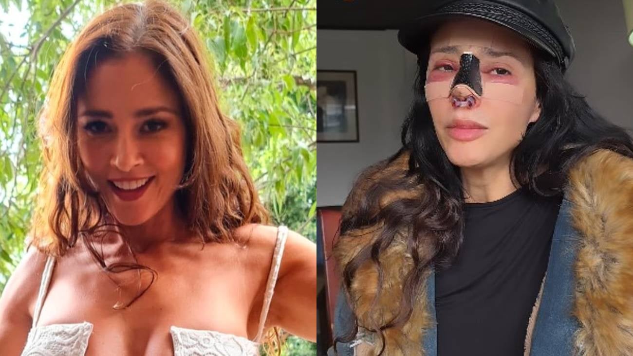 FOTOS: Dorismar reaparece con el rostro desfigurado tras mala cirugía estética