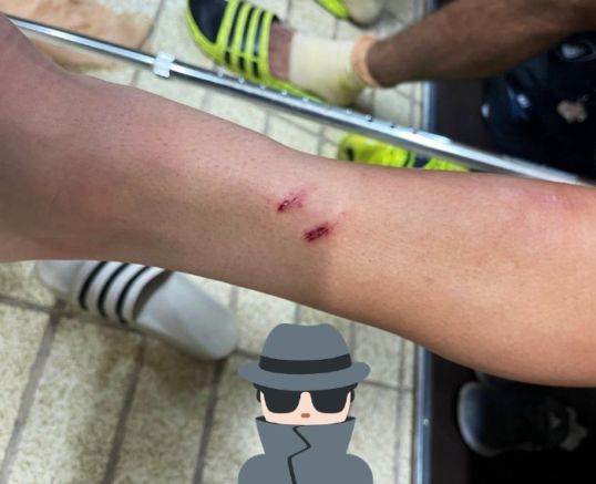Herida de Marco García tras el Querétaro vs Pumas