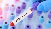 ¿Tengo gripe H3N2 tipo K? Así es la prueba que detecta esta “súper gripe”