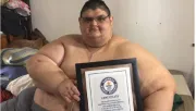 Muere Juan Pedro Franco a los 41 años, el hombre más obeso del mundo originario de México