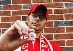 Ryan Gibson muestra su ojo de vidrio