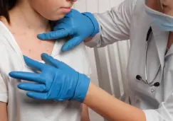 Vacuna contra el sarampión gratis en la UNAM: horarios, requisitos y sede 2025