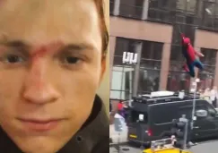 El actor se está recuperando tras golpearse en la cabeza.