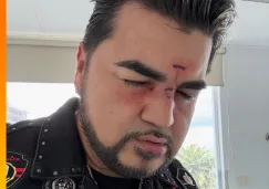 El cantante agradeció al doctor que lo atendió por sus heridas.