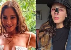 FOTOS: Dorismar reaparece con el rostro desfigurado tras mala cirugía estética