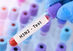 ¿Tengo gripe H3N2 tipo K? Así es la prueba que detecta esta “súper gripe”