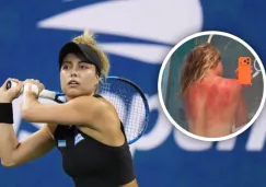 Las marcas del sol en la espalda de Renata Zarazúa durante la gira australiana