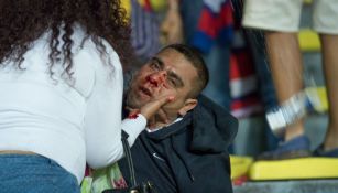 Un aficioando resultó herido tras la pelea