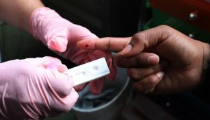 VIH: México participará en ensayo para vacuna contra el SIDA