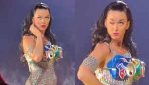 Katy Perry y el 'accidente' de su ojo