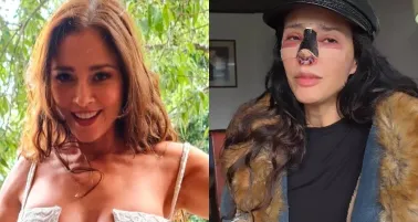 FOTOS: Dorismar reaparece con el rostro desfigurado tras mala cirugía estética