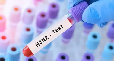 ¿Tengo gripe H3N2 tipo K? Así es la prueba que detecta esta “súper gripe”