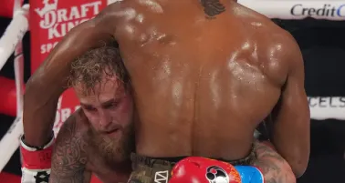 Jake Paul muestra doble fractura de mandíbula tras pelea contra Anthony Joshua 