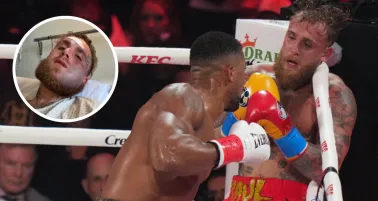 ¡Irreconocible! Así quedó Jake Paul tras su pelea ante Anthony Joshua