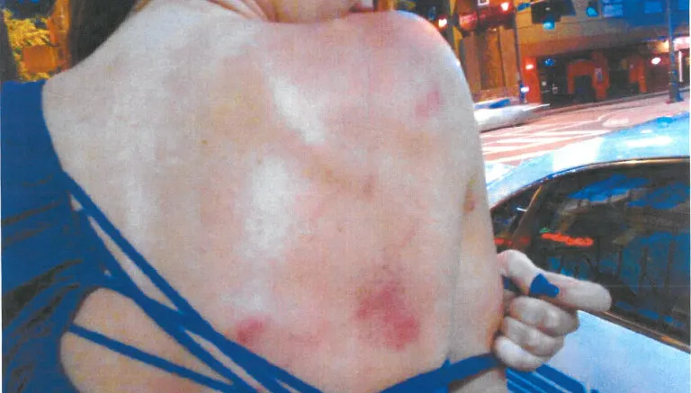 DEADSPIN Golpes en el cuerpo de Nicole Holder