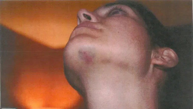 DEADSPIN Golpes en el cuello y la barbilla