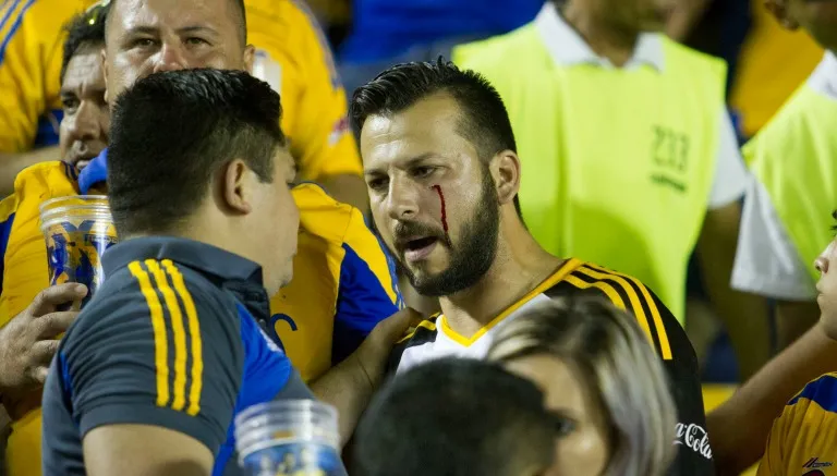 MEXSPORT Aficionado de Tigres luce una herida en la cara