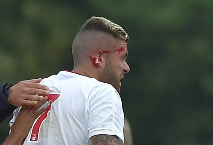 ESPECIAL Ménez sangra al salir del campo