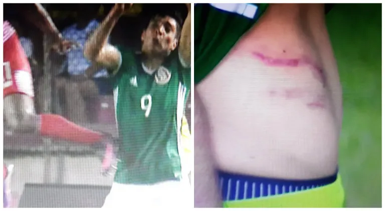 ESPECIAL La fuerte entrada Sufrida por Jiménez