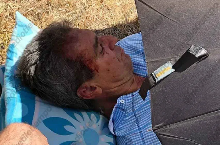 Néstor sufrió golpes en el cuerpo y rostro