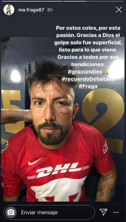 Así quedó Miguel Fraga