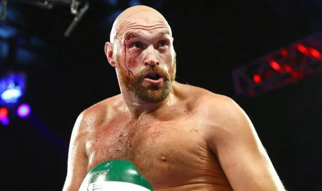 Tyson Fury durante la pelea