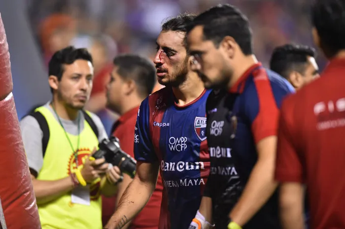 IMAGO7 Sosa, lesionado