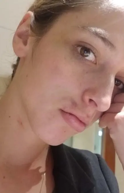 ESPECIAL Evidencia de las agresiones de Fernanado Daniel a Edna