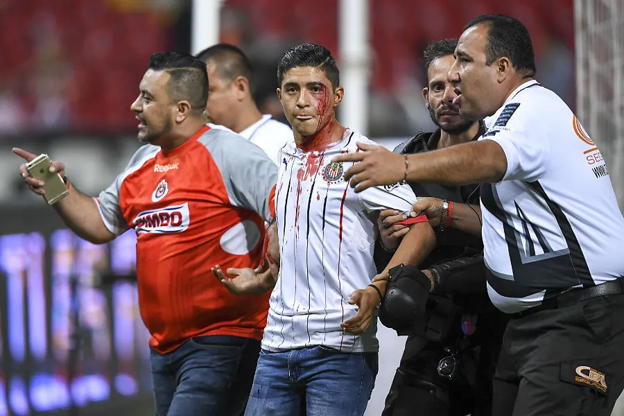IMAGO7 Seguidor de Chivas herido por una pelea