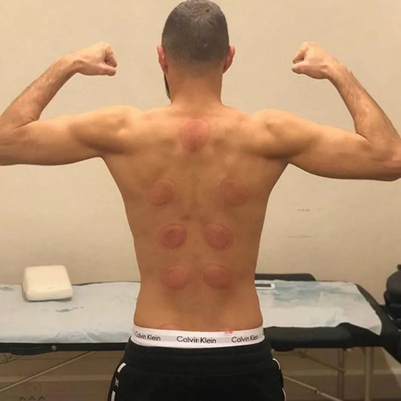 INSTAGRAM:@KARIMBENZEMA Benzema en un tratamiento