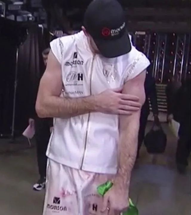 Callum Smith después de la pelea