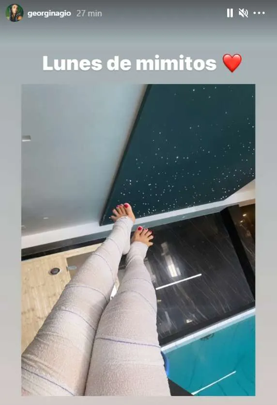 Tratamiento Georgina Rodríguez