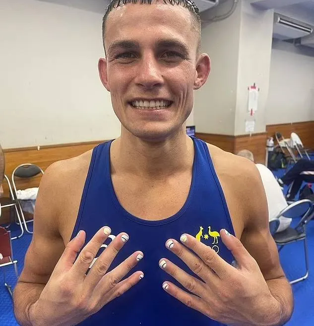 INSTAGRAM: @Harry_garside Harry mostrando sus uñas después de su última pelea