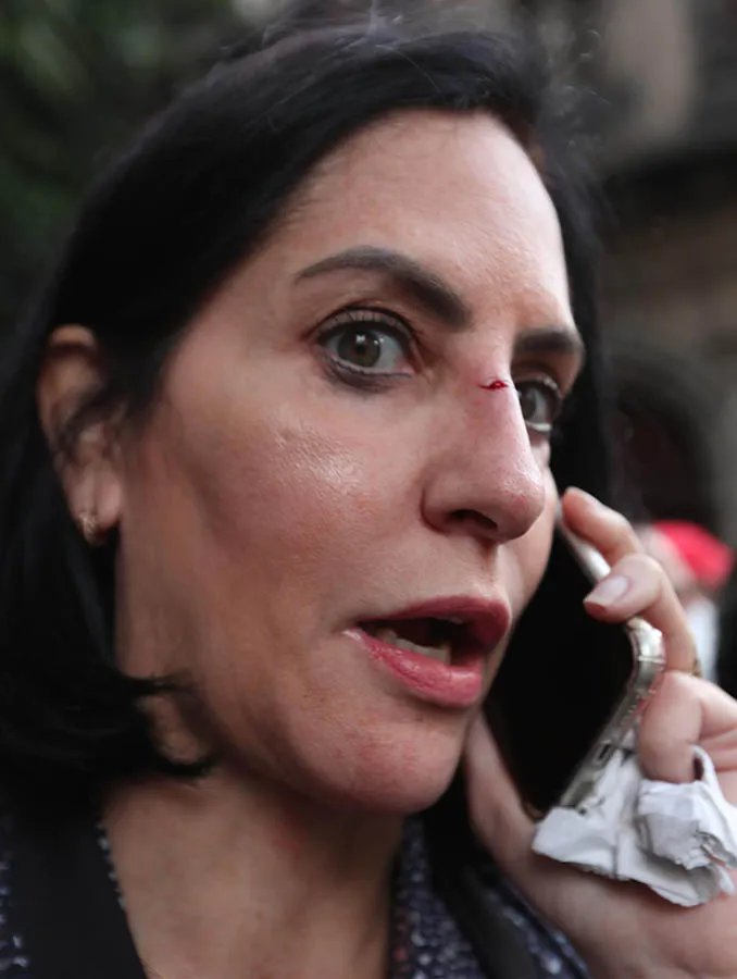 Lía Limón con herida en la nariz