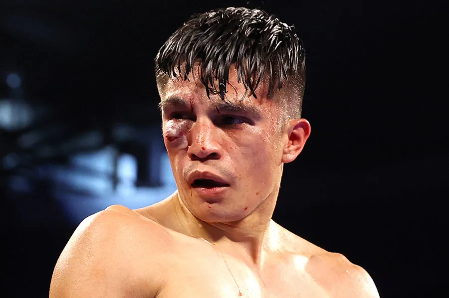 Así quedó el rostro de González, tras la reyerta ante Navarrete