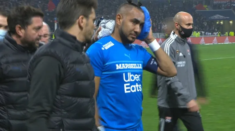 ESPECIAL Dimitri Payet tras ser agredido en el Lyon-Marsella