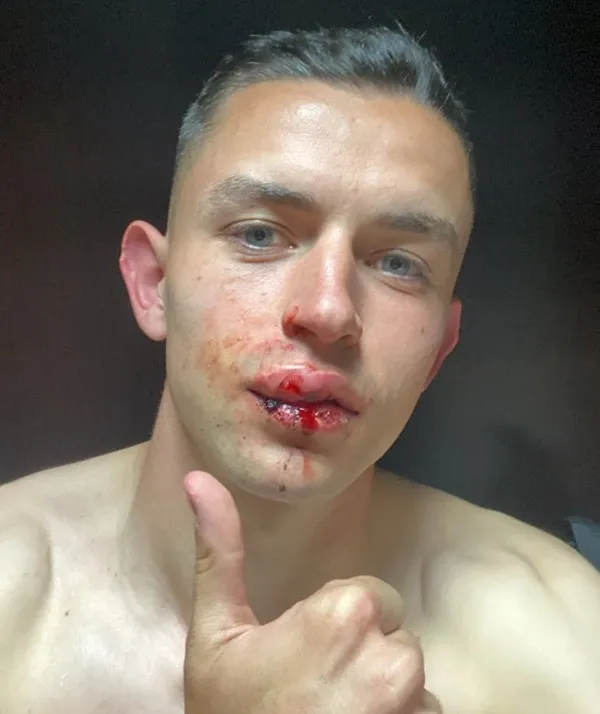 Álvaro Fidalgo tras partido contra Santos