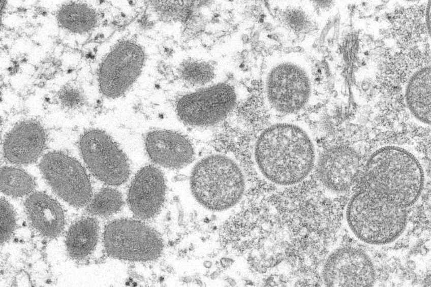 AP Virus de la viruela del mono vista desde un microscopio