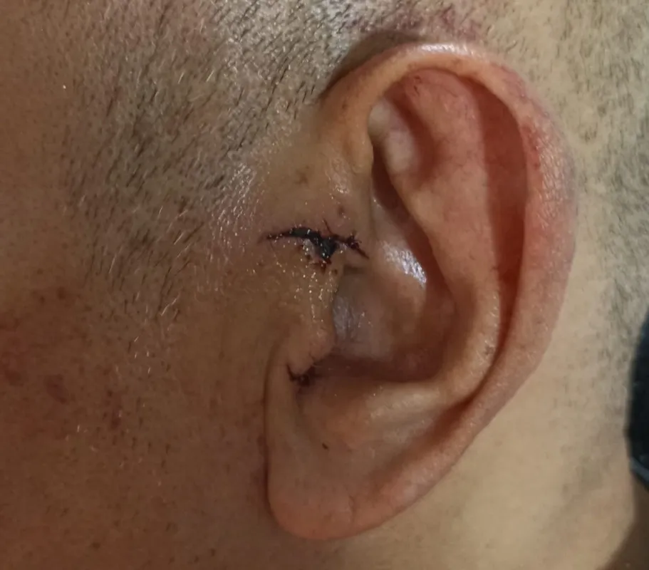 Heridas de Villano IV